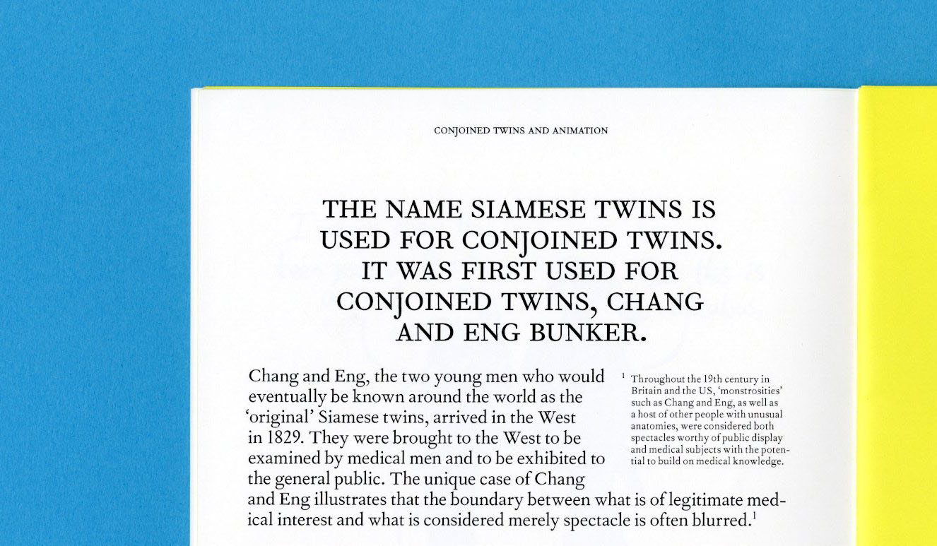 Conjoined Twins and the Animated World