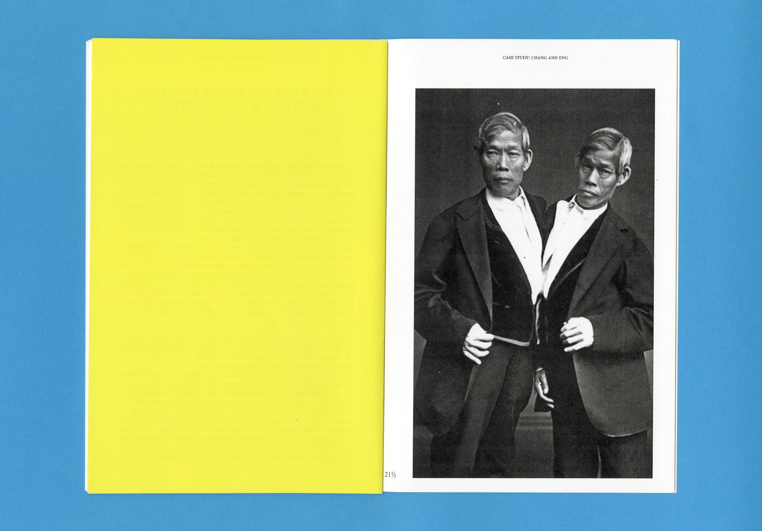 Conjoined Twins and the Animated World