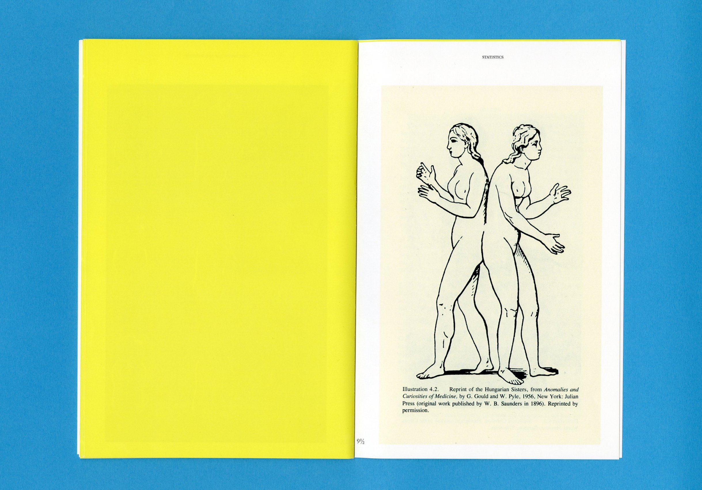 Conjoined Twins and the Animated World