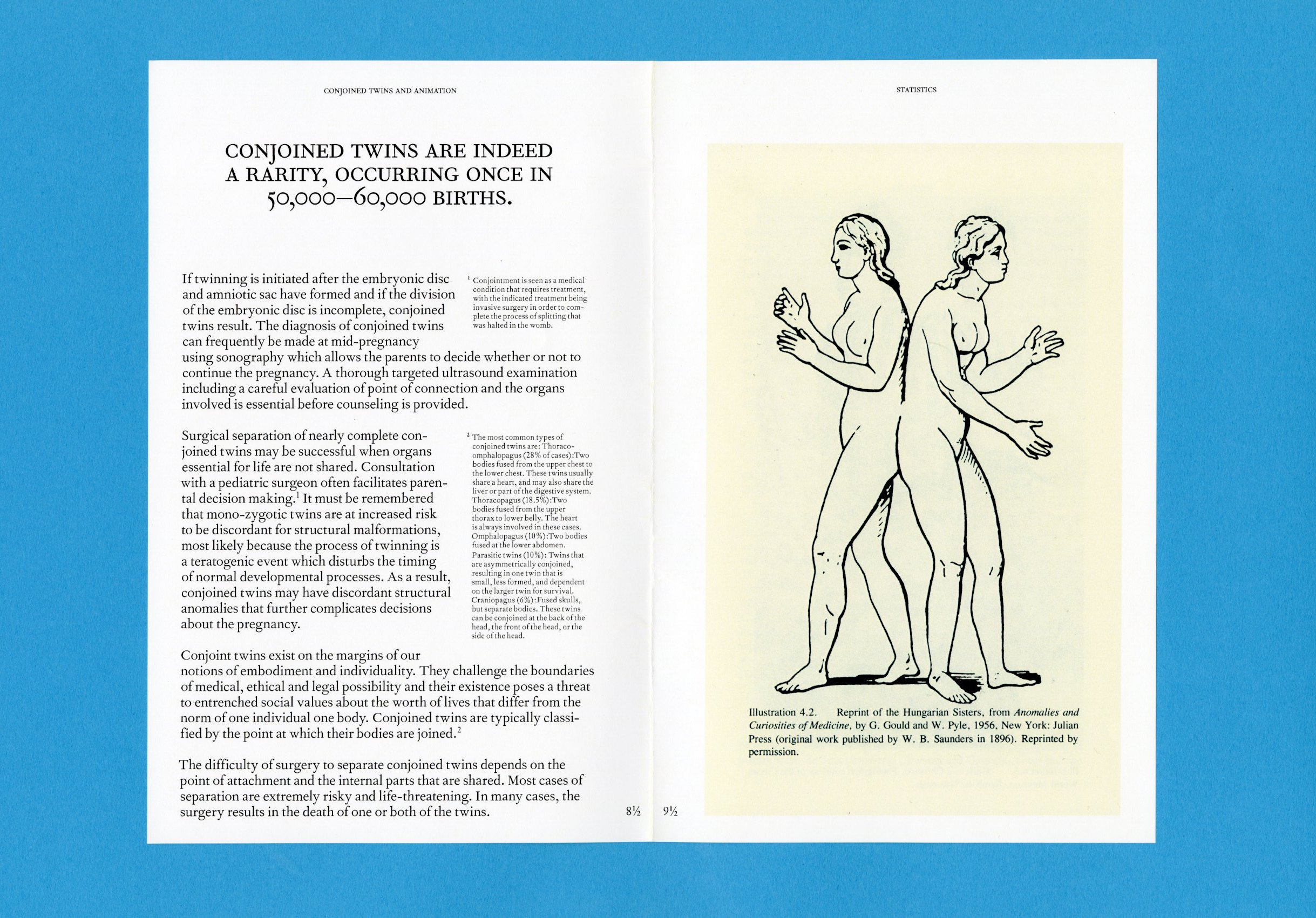 Conjoined Twins and the Animated World