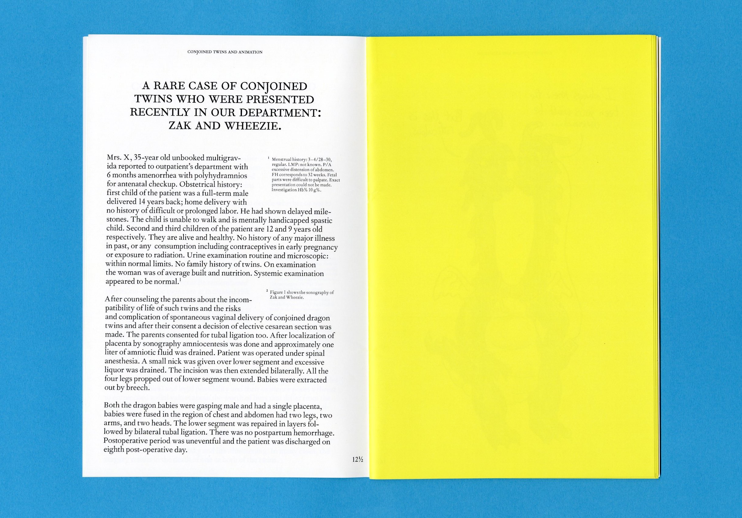 Conjoined Twins and the Animated World